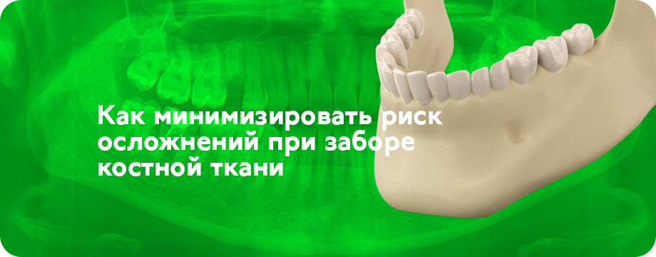 Анализ расположения резцовой петли при планировании забора костного блока в подбородочном отделе нижней челюсти.jpg Анализ расположения резцовой петли при планировании забора костного блока в подбородочном отделе нижней челюсти.jpg