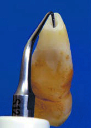 Acteon S12-70D – Насадка с алмазным покрытием