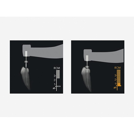 J.Morita Tri Auto ZX2 - беспроводной эндодонтический микромотор со встроенным апекслокатором