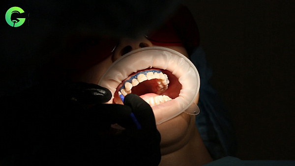 Лампа Amazing White_00.37.jpg