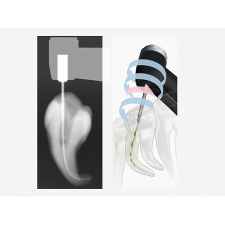 J.Morita Tri Auto ZX2 - беспроводной эндодонтический микромотор со встроенным апекслокатором