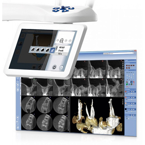 Planmeca ProMax 3D Plus - аппарат 3D визуализации