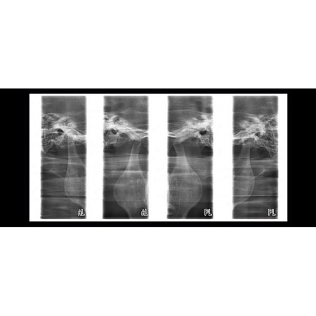 Planmeca ProOne - универсальный цифровой ортопантомограф