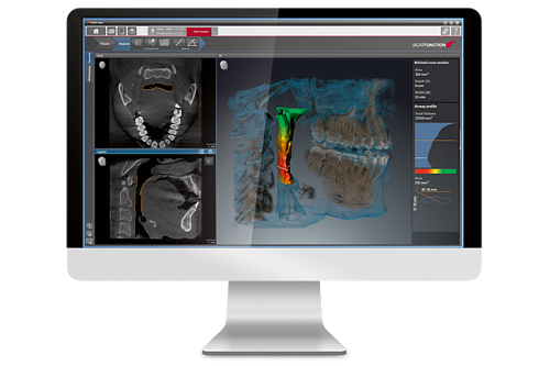 Sirona Orthophos SL 3D (11x10) – Дентальный томограф