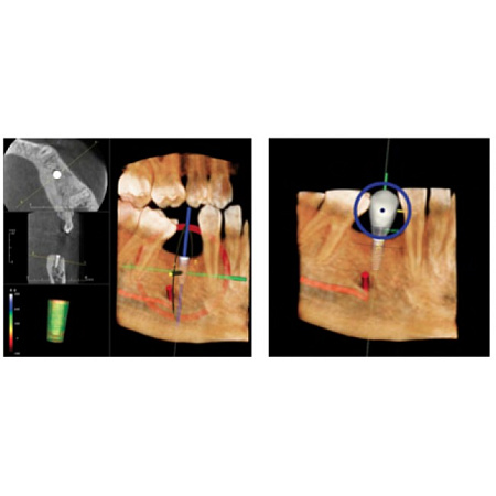 KaVo GENDEX GXDP-700 - цифровая панорамная рентгенодиагностическая система с возможностью дооснащения модулем цефалостата и функцией 3D-томографии 